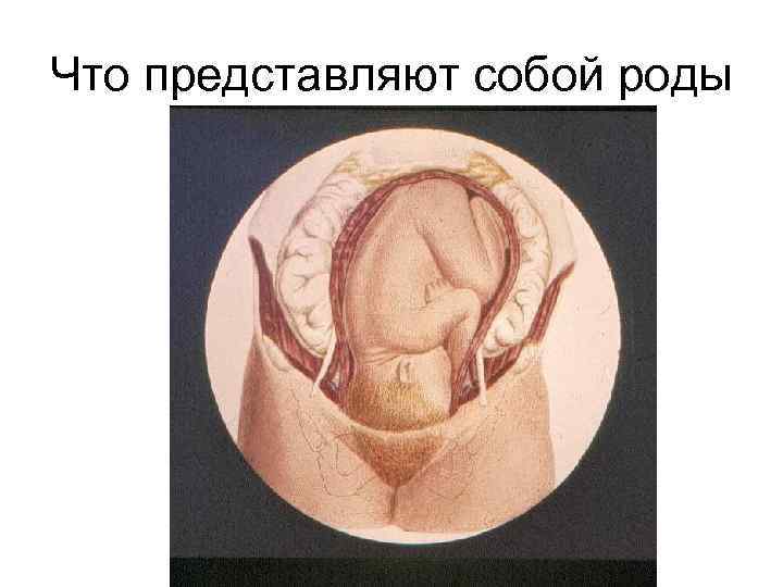 Что представляют собой роды 