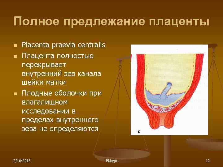 Полное предлежание плаценты n n n Placenta praevia centralis Плацента полностью перекрывает внутренний зев