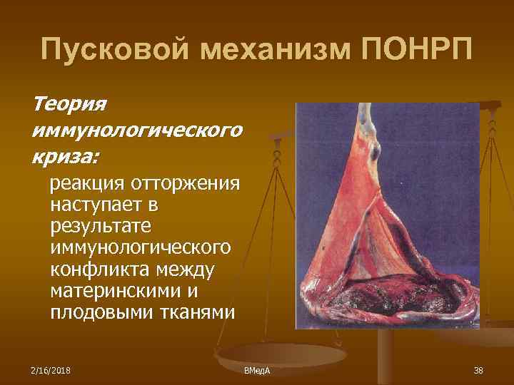 Пусковой механизм ПОНРП Теория иммунологического криза: реакция отторжения наступает в результате иммунологического конфликта между
