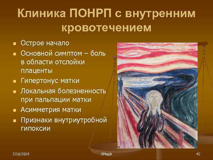 Клиника ПОНРП с внутренним кровотечением n n n Острое начало Основной симптом – боль