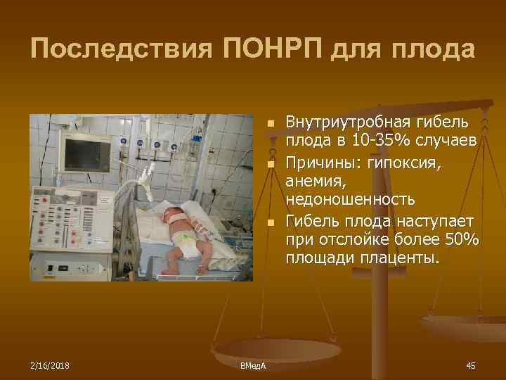 Последствия ПОНРП для плода n n n 2/16/2018 ВМед. А Внутриутробная гибель плода в