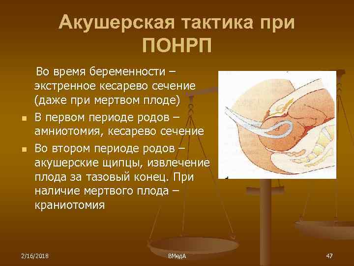 Акушерская тактика при ПОНРП n n Во время беременности – экстренное кесарево сечение (даже