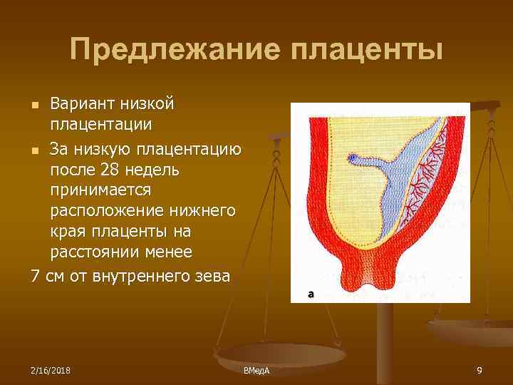 Предлежание плаценты Вариант низкой плацентации n За низкую плацентацию после 28 недель принимается расположение