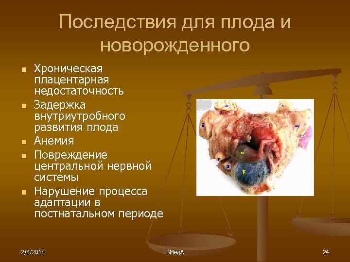 Последствия для плода и новорожденного n n n Хроническая плацентарная недостаточность Задержка внутриутробного развития