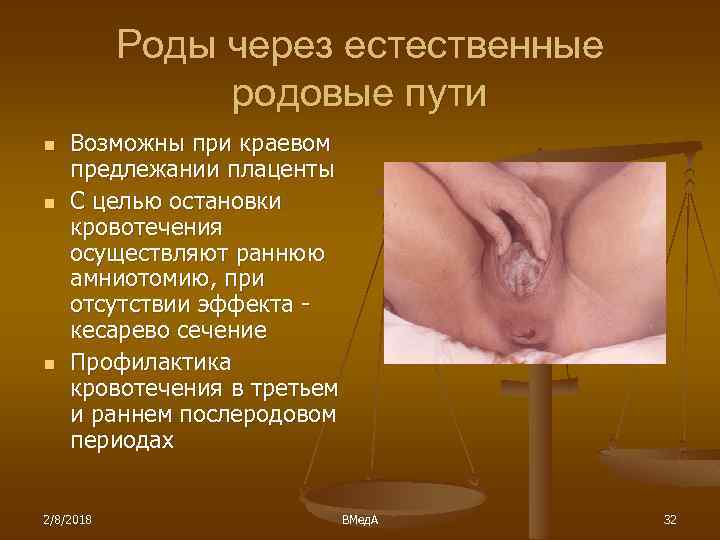 Роды через естественные родовые пути n n n Возможны при краевом предлежании плаценты С