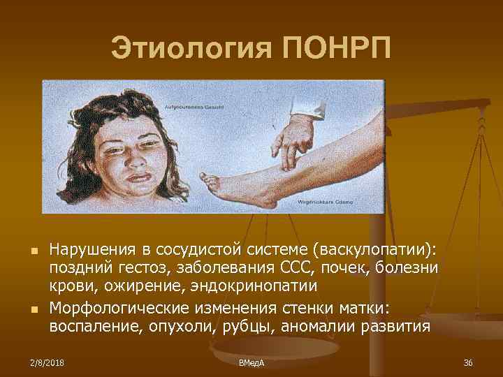 Этиология ПОНРП n n Нарушения в сосудистой системе (васкулопатии): поздний гестоз, заболевания ССС, почек,