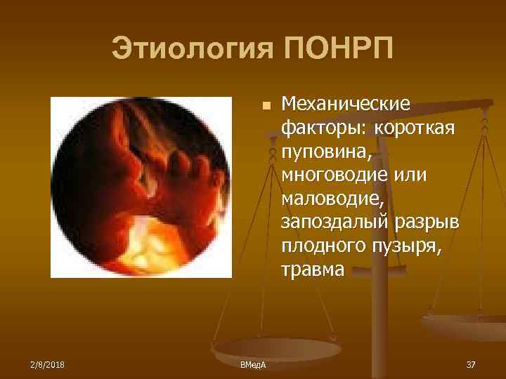 Этиология ПОНРП n 2/8/2018 ВМед. А Механические факторы: короткая пуповина, многоводие или маловодие, запоздалый