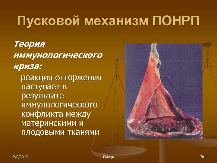 Пусковой механизм ПОНРП Теория иммунологического криза: реакция отторжения наступает в результате иммунологического конфликта между