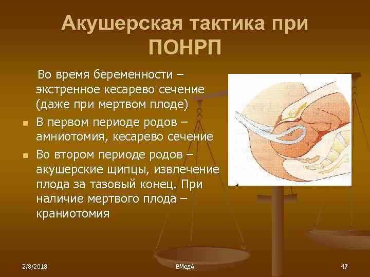 Акушерская тактика при ПОНРП n n Во время беременности – экстренное кесарево сечение (даже