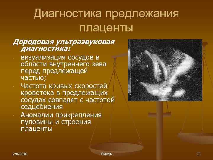 Диагностика предлежания плаценты Дородовая ультразвуковая диагностика: - - - визуализация сосудов в области внутреннего