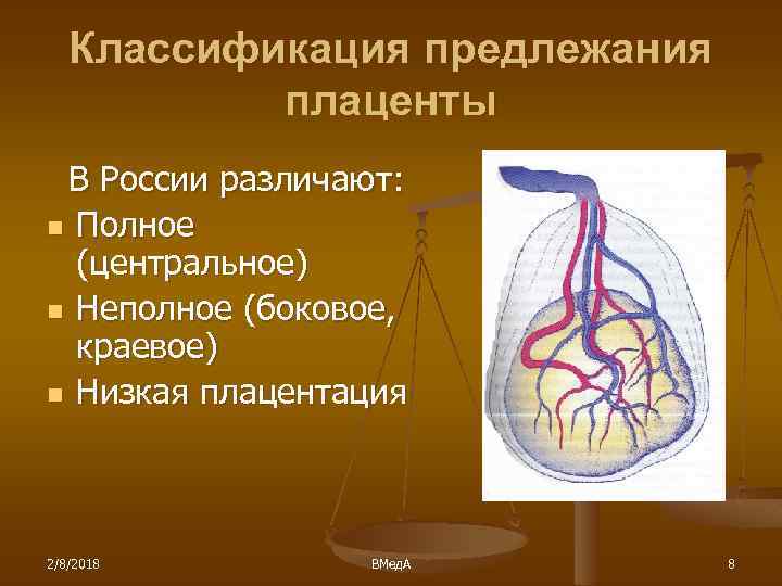 Классификация предлежания плаценты В России различают: n Полное (центральное) n Неполное (боковое, краевое) n