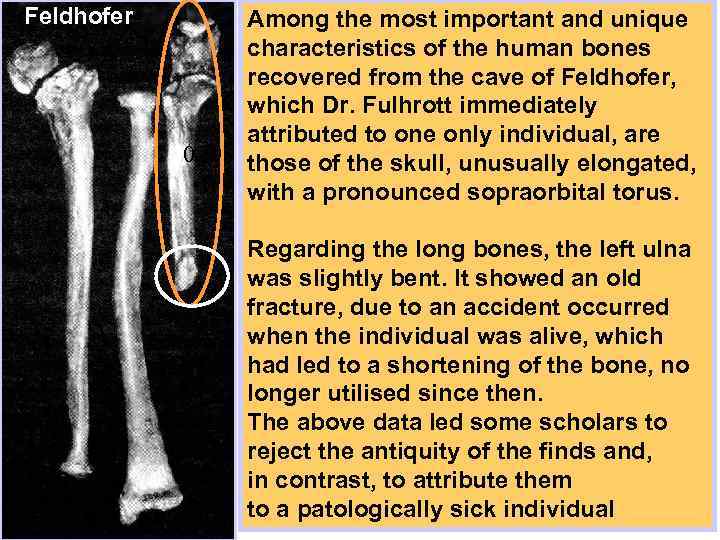 Feldhofer 0 Among the most important and unique characteristics of the human bones recovered