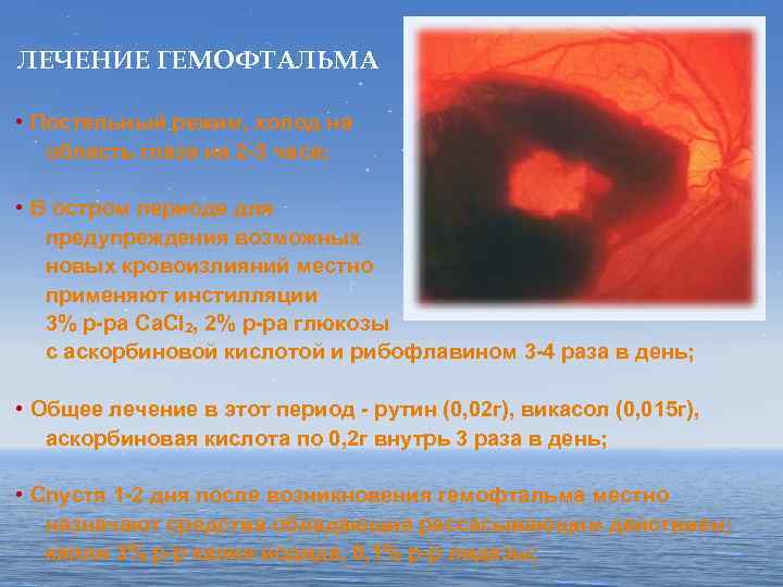 ЛЕЧЕНИЕ ГЕМОФТАЛЬМА • Постельный режим, холод на область глаза на 2 -3 часа; •