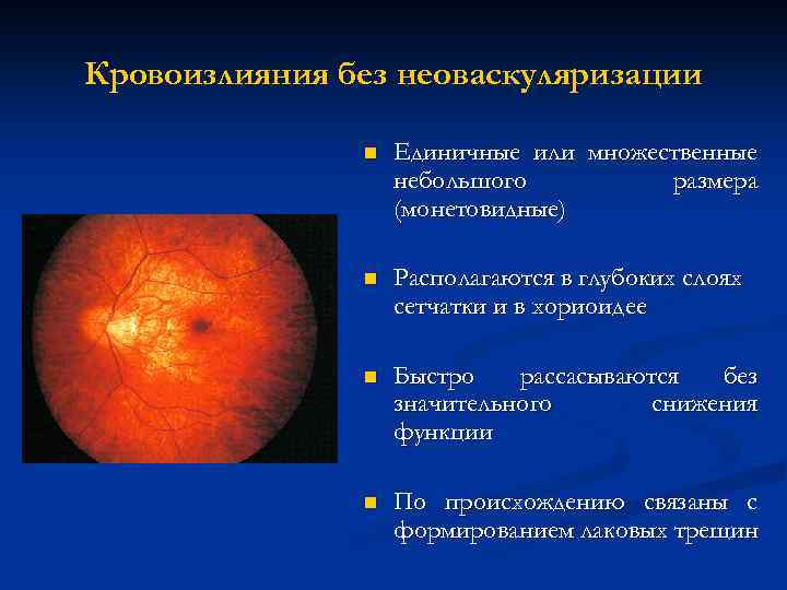 Кровоизлияния без неоваскуляризации n Единичные или множественные небольшого размера (монетовидные) n Располагаются в глубоких