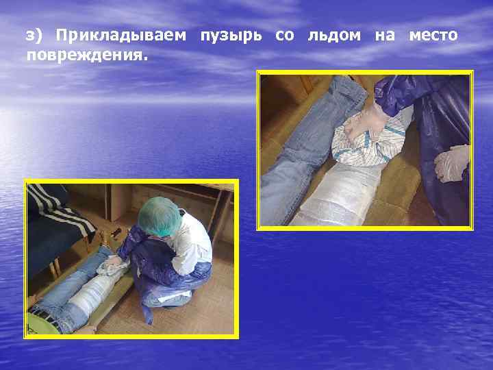 з) Прикладываем пузырь со льдом на место повреждения. 