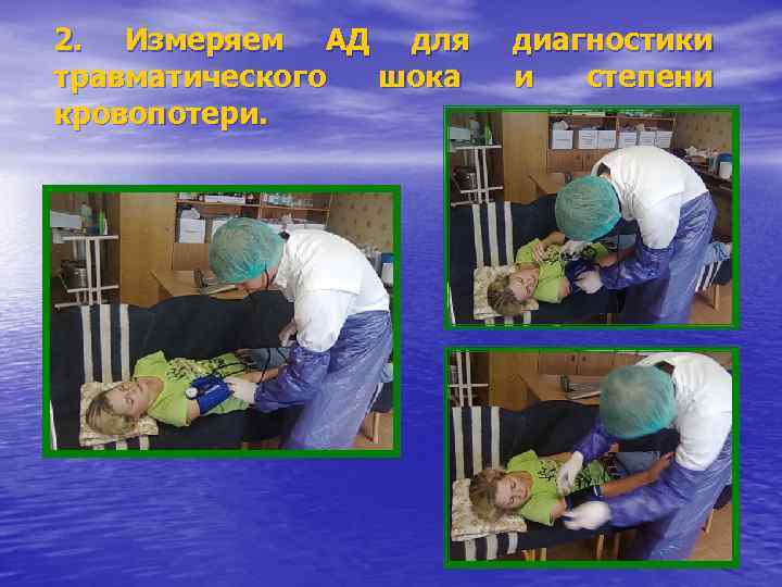 2. Измеряем АД для травматического шока кровопотери. диагностики и степени 