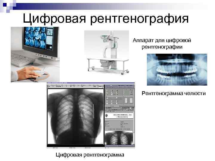 Информативность рентгеновского изображения