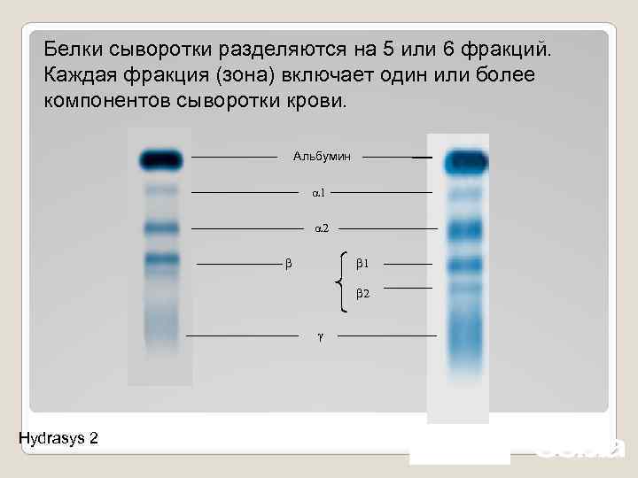 Белок 1. Исследование белковых фракций. Фракции белков с примерами. Белки сыворотки крови α2-макроглобулин. Белковые фракции пример белков.