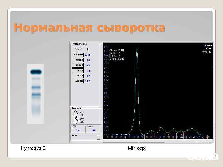 Нормальная сыворотка Hydrasys 2 Minicap 