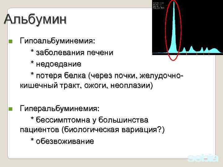 Альбумин n Гипоальбуминемия: * заболевания печени * недоедание * потеря белка (через почки, желудочнокишечный