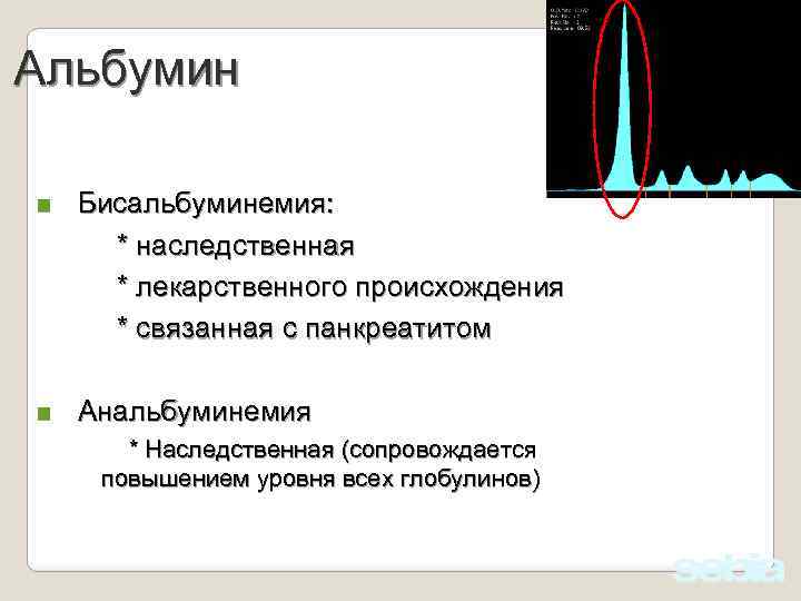 Альбумин n Бисальбуминемия: * наследственная * лекарственного происхождения * связанная с панкреатитом n Анальбуминемия