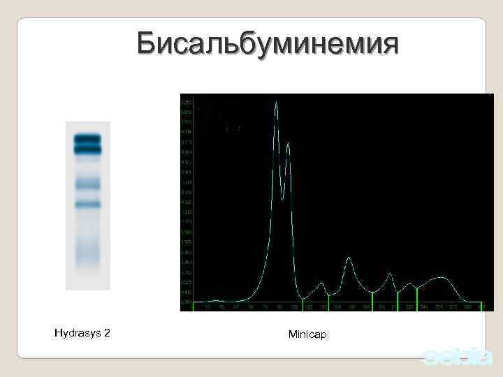 Бисальбуминемия Hydrasys 2 Minicap 