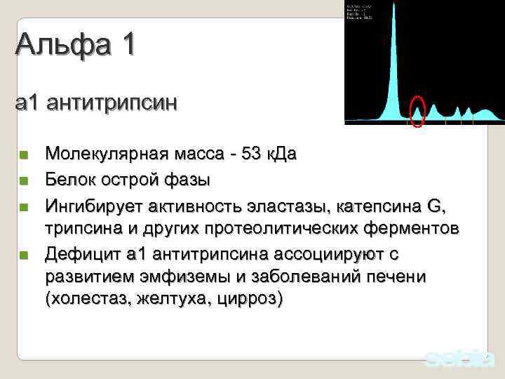 Альфа 1 антитрипсин n n Молекулярная масса - 53 к. Да Белок острой фазы