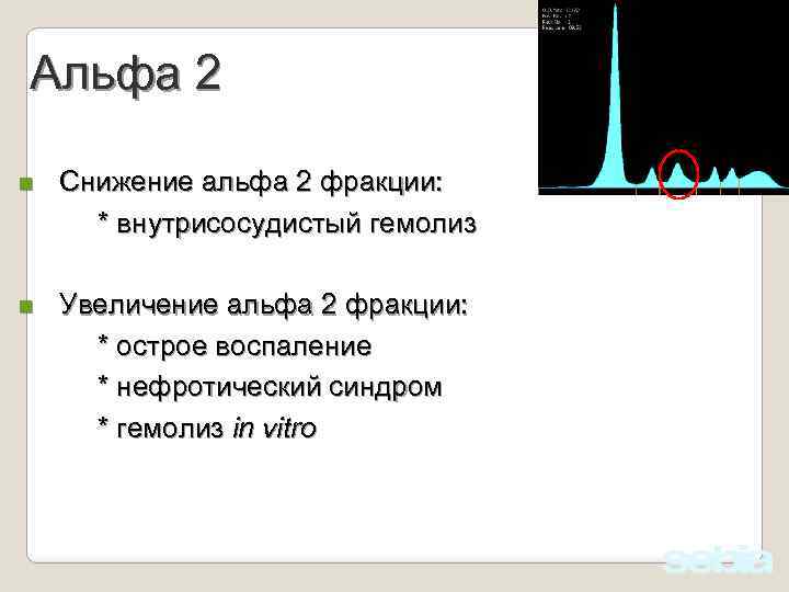 Альфа 2 n Снижение альфа 2 фракции: * внутрисосудистый гемолиз n Увеличение альфа 2