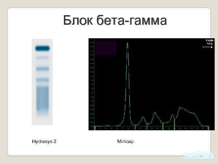 Блок бета-гамма Hydrasys 2 Minicap 