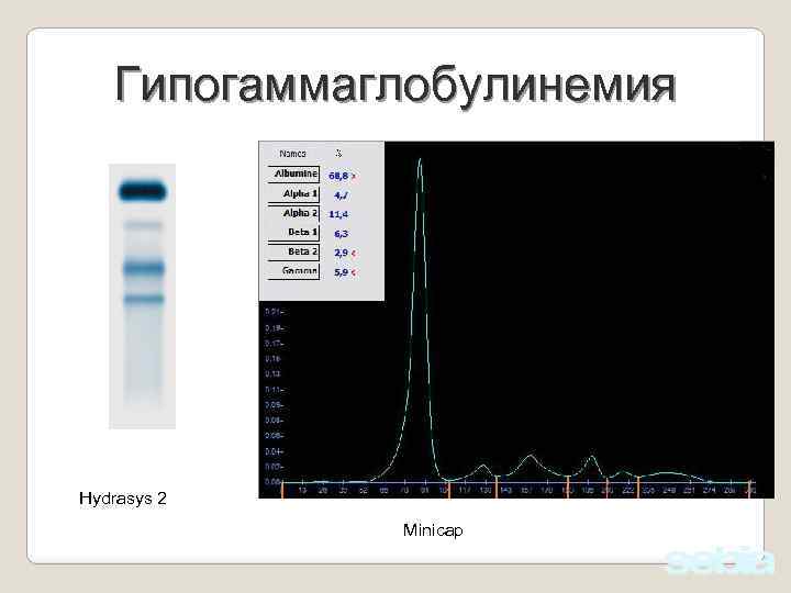 Гипогаммаглобулинемия Hydrasys 2 Minicap 