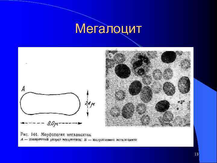 Мегалоцит 13 