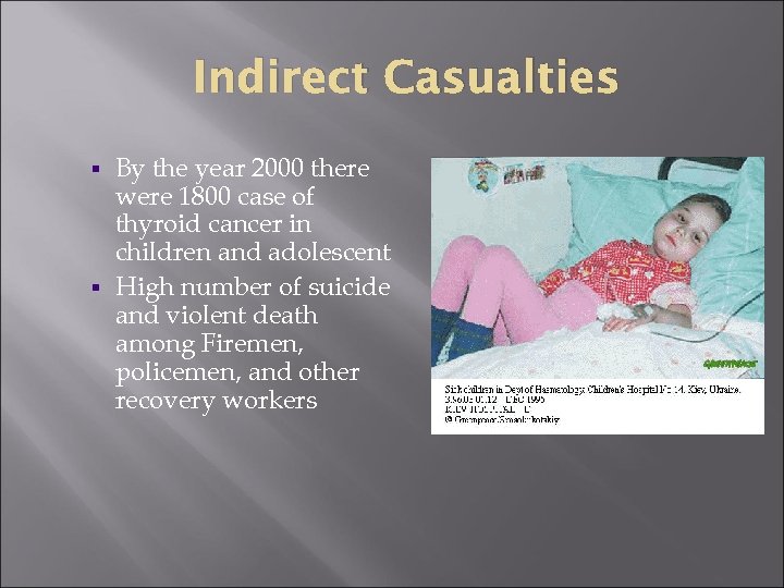 Indirect Casualties By the year 2000 there were 1800 case of thyroid cancer in