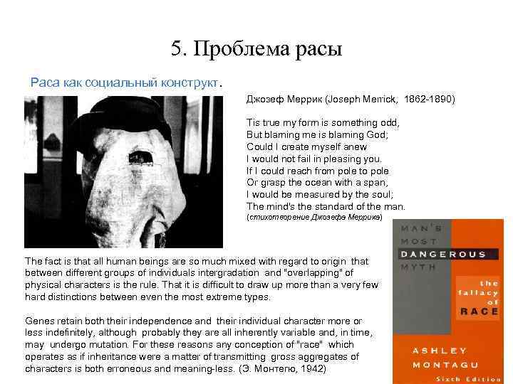 5. Проблема расы Раса как социальный конструкт. Джозеф Меррик (Joseph Merrick, 1862 -1890) Tis