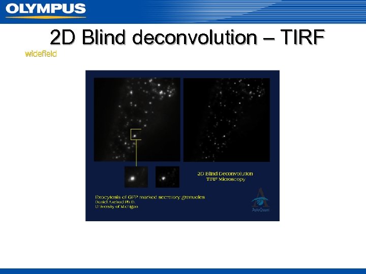 2 D Blind deconvolution – TIRF widefield 