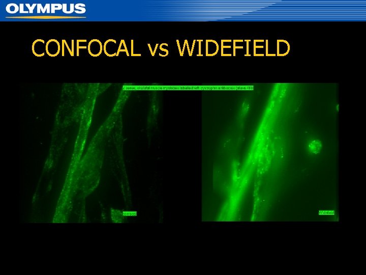 CONFOCAL vs WIDEFIELD 