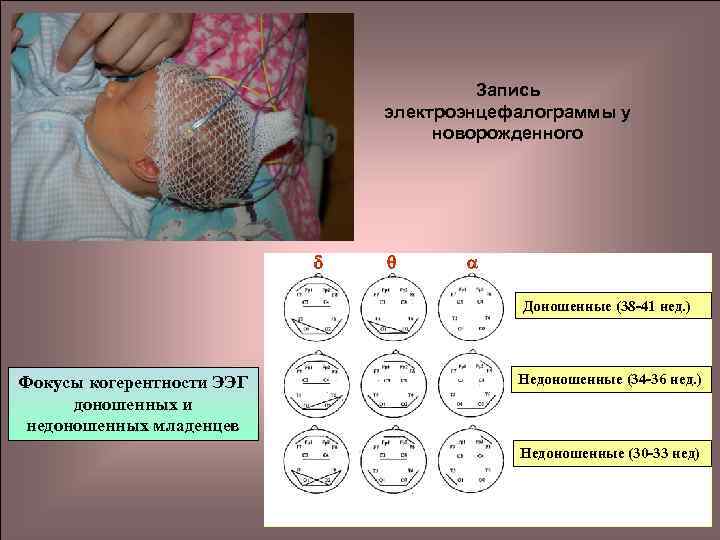 Окружность головы недоношенного