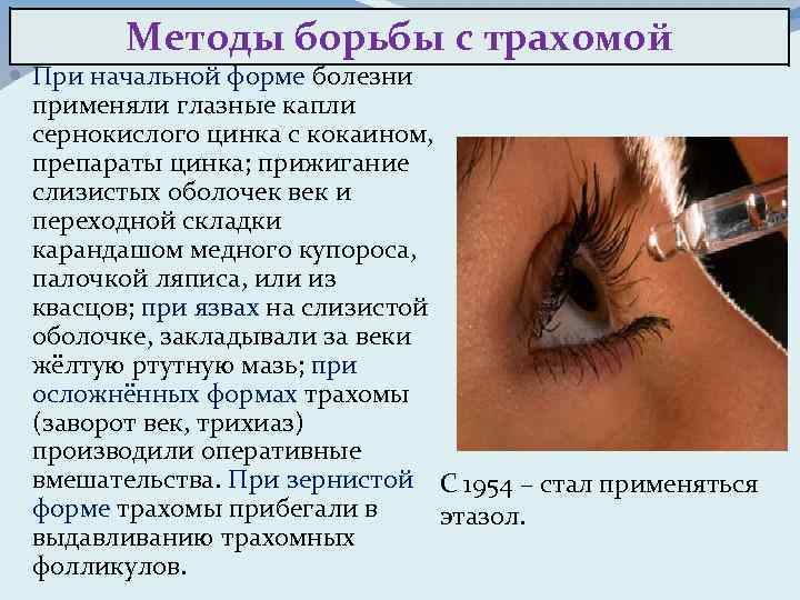 Для лечения заболевания глаз применяют 0.5