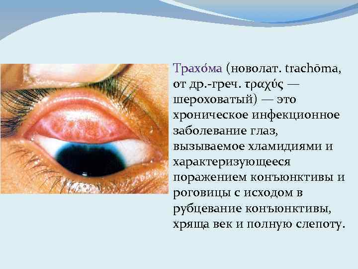 Трахо ма (новолат. trachōma, от др. -греч. τραχύς — шероховатый) — это хроническое инфекционное