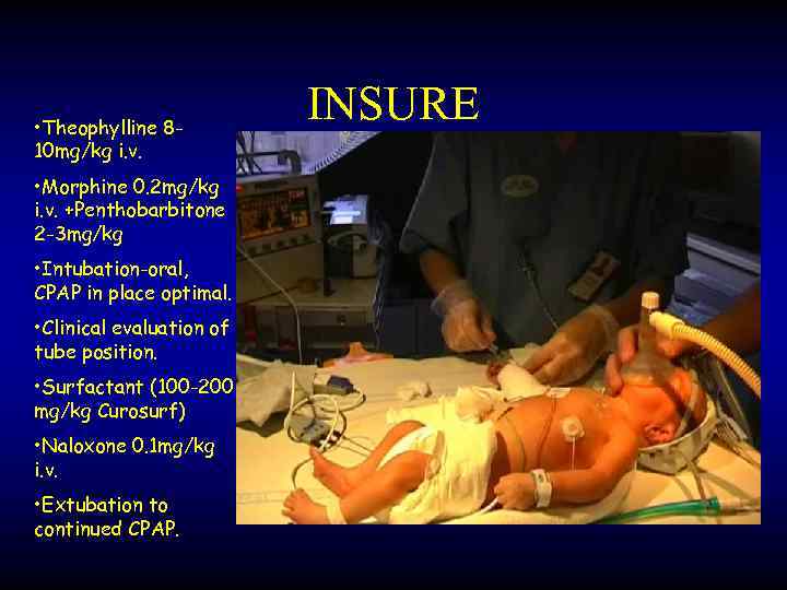  • Theophylline 810 mg/kg i. v. • Morphine 0. 2 mg/kg i. v.