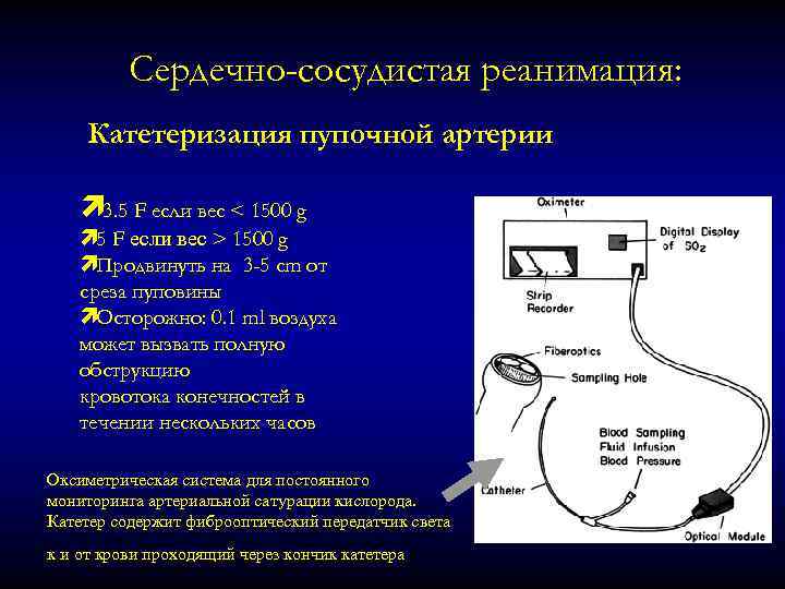 Сердечно-сосудистая реанимация: Катетеризация пупочной артерии ì 3. 5 F если вес < 1500 g