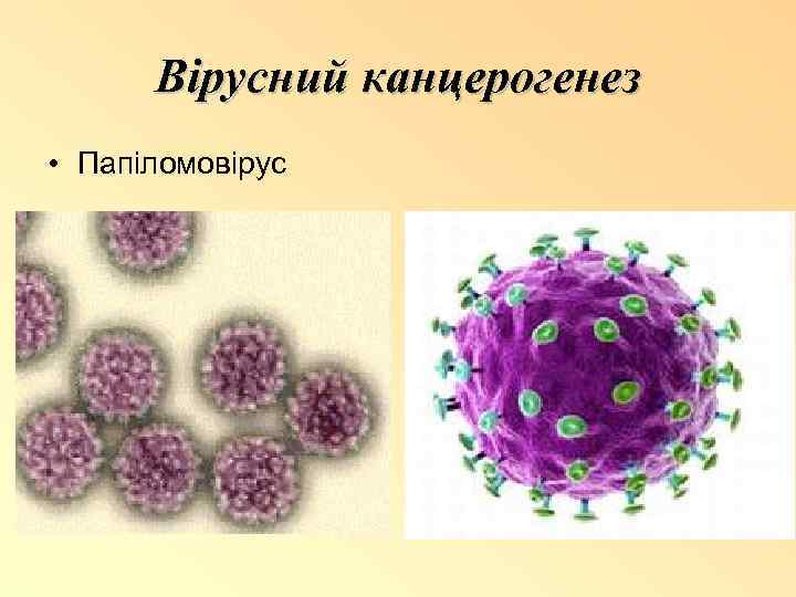 Вірусний канцерогенез • Папіломовірус 