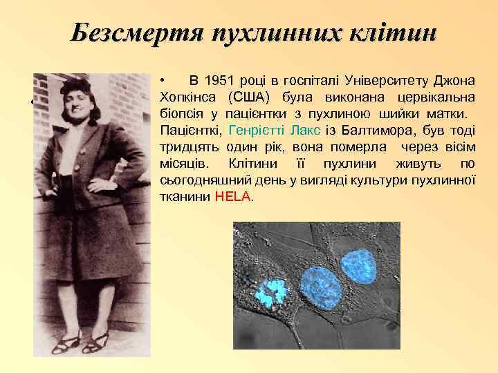 Безсмертя пухлинних клітин • 1 • В 1951 році в госпіталі Університету Джона Хопкінса