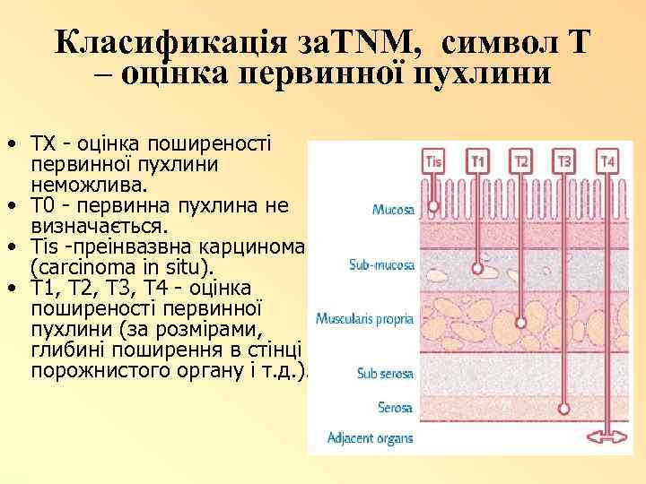 Класификація за. TNM, символ Т – оцінка первинної пухлини • ТХ - оцінка поширеності