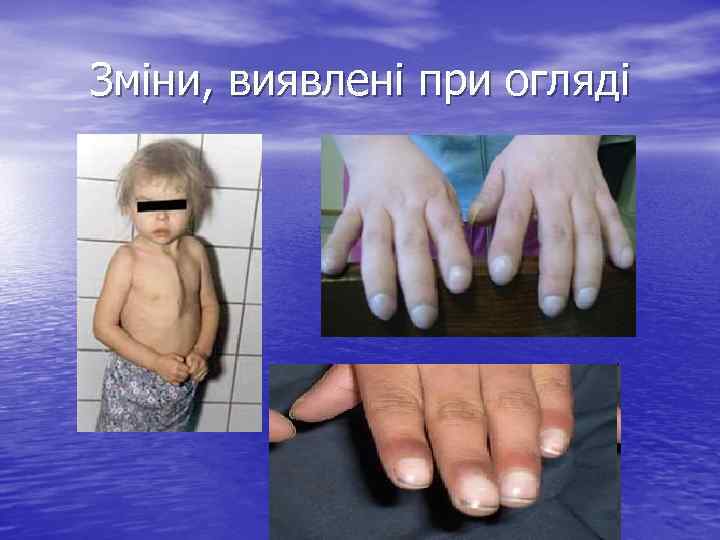 Зміни, виявлені при огляді 