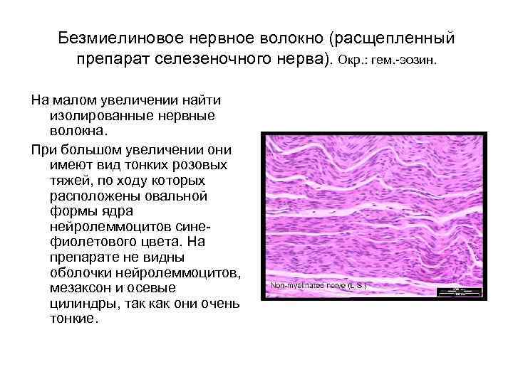 Безмиелиновые нервные волокна гистология рисунок
