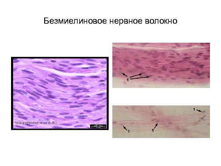 Безмиелиновые нервные волокна гистология рисунок