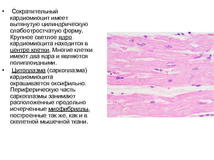  • Сократительный кардиомиоцит имеет вытянутую цилиндрическую слабоотростчатую форму. Крупное светлое ядро кардиомиоцита находится