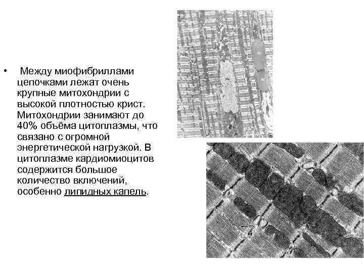  • Между миофибриллами цепочками лежат очень крупные митохондрии с высокой плотностью крист. Митохондрии