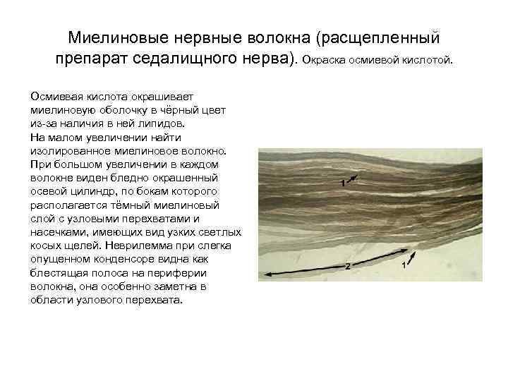 Миелиновые нервные волокна (расщепленный препарат седалищного нерва). Окраска осмиевой кислотой. Осмиевая кислота окрашивает миелиновую