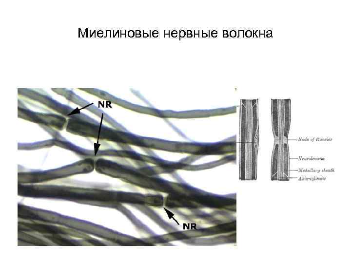 Миелиновые нервные волокна 